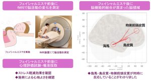 心地よいフェイシャルエステに関連する脳の活動領域を解明｜日本メナード化粧品