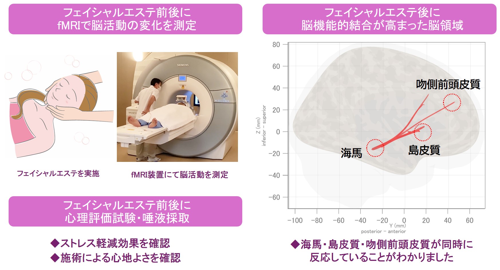 心地よいフェイシャルエステに関連する脳の活動領域を解明｜日本メナード化粧品