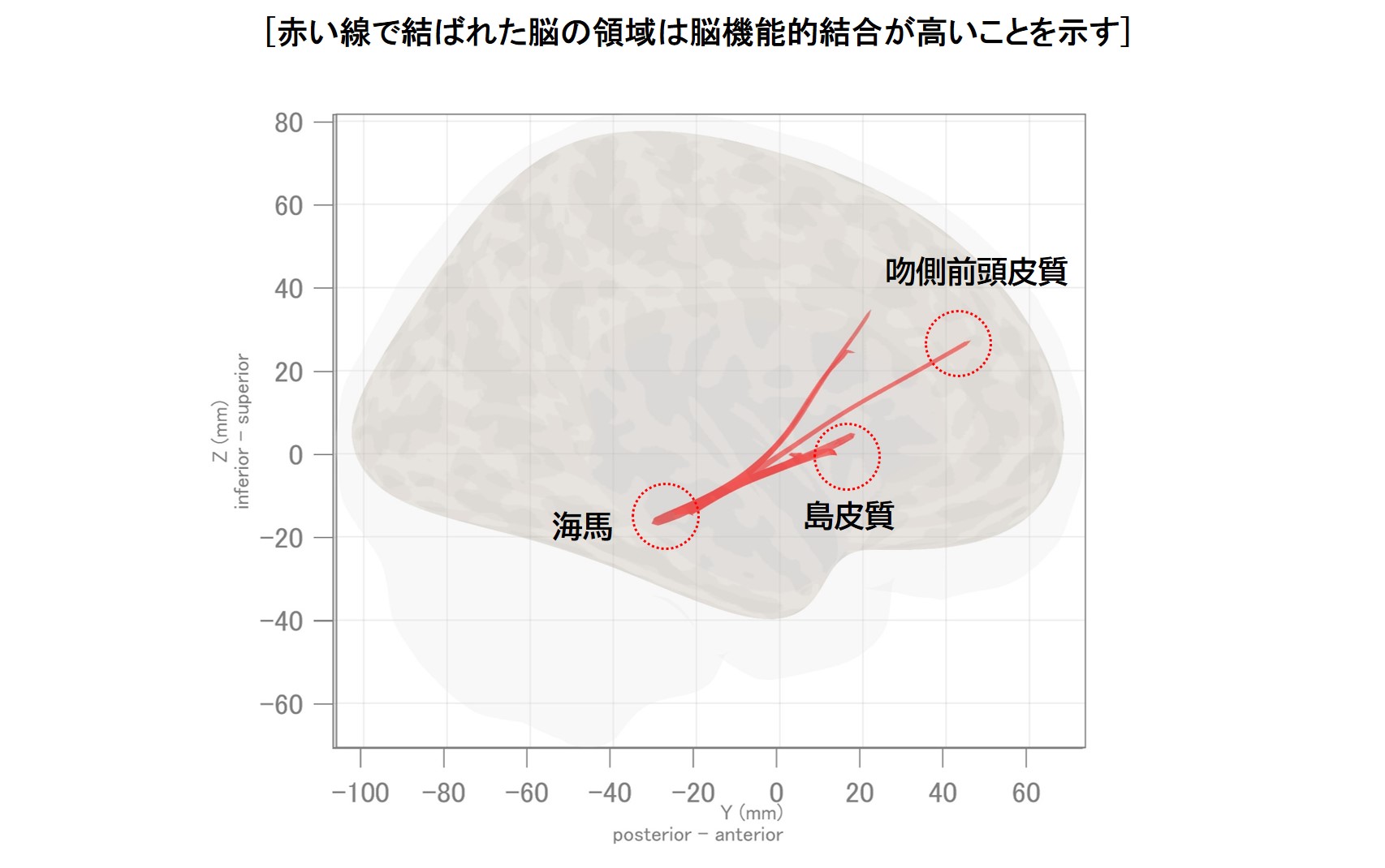 心地よいフェイシャルエステに関連する脳の活動領域を解明|日本メナード化粧品